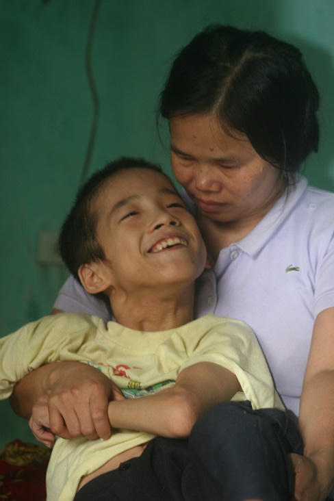 Đau lòng cảnh mẹ mù lòa chăm con bị bại não